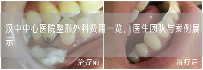 汉中中心医院整形外科费用一览，医生团队与案例展示