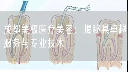 成都美极医疗美容：揭秘其卓越服务与专业技术