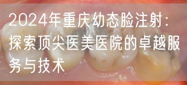 2024年重庆幼态脸注射：探索顶尖医美医院的卓越服务与技术