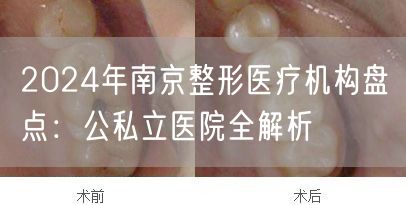 2024年南京整形医疗机构盘点：公私立医院全解析