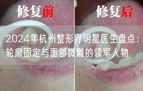 2024年杭州整形界明星医生盘点：轮廓固定与面部微雕的领军人物
