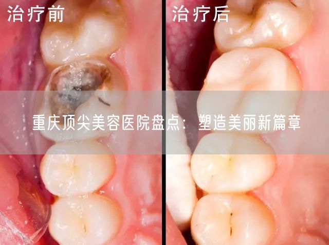 重庆顶尖美容医院盘点：塑造美丽新篇章