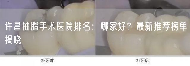 许昌抽脂手术医院排名：哪家好？最新推荐榜单揭晓
