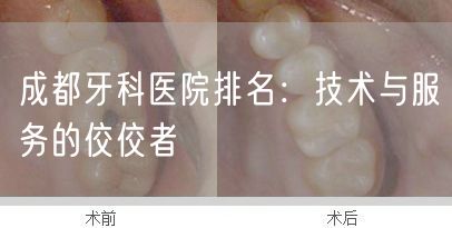 成都牙科医院排名：技术与服务的佼佼者