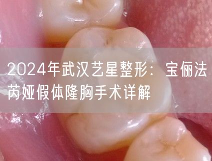 2024年武汉艺星整形：宝俪法芮娅假体隆胸手术详解
