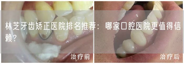 林芝牙齿矫正医院排名推荐：哪家口腔医院更值得信赖？