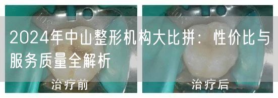 2024年中山整形机构大比拼：性价比与服务质量全解析