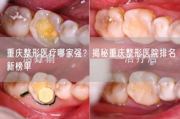 重庆整形医疗哪家强？揭秘重庆整形医院排名新榜单