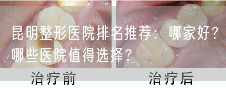 昆明整形医院排名推荐：哪家好？哪些医院值得选择？