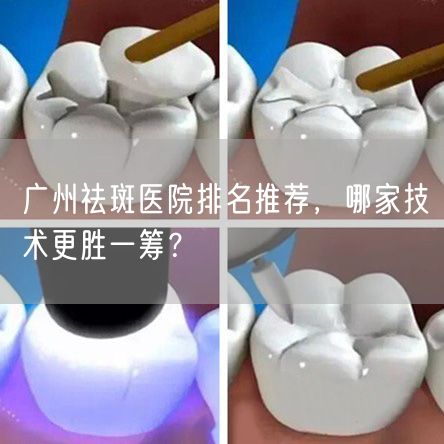 广州祛斑医院排名推荐，哪家技术更胜一筹？