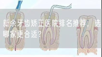 新余牙齿矫正医院排名推荐，选哪家更合适？