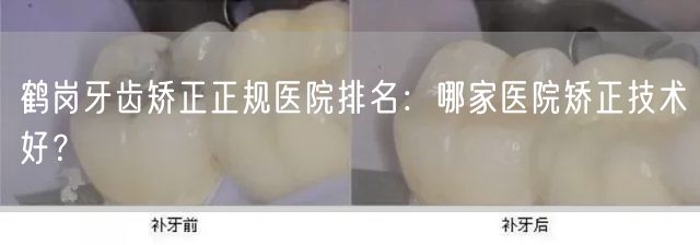 鹤岗牙齿矫正正规医院排名：哪家医院矫正技术好？