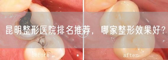 昆明整形医院排名推荐，哪家整形效果好？