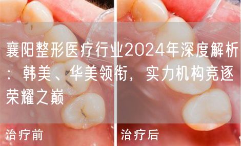 襄阳整形医疗行业2024年深度解析：韩美、华美领衔，实力机构竞逐荣耀之巅