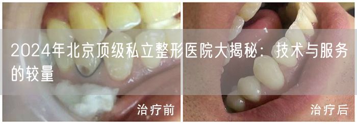 2024年北京顶级私立整形医院大揭秘：技术与服务的较量