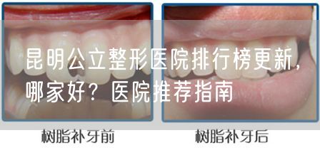 昆明公立整形医院排行榜更新，哪家好？医院推荐指南