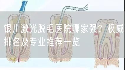 银川激光脱毛医院哪家强？权威排名及专业推荐一览