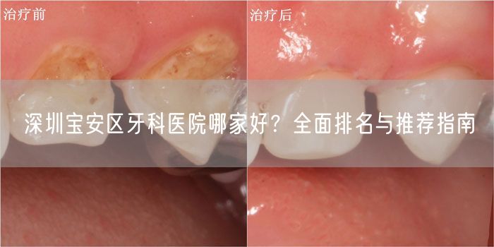 深圳宝安区牙科医院哪家好？全面排名与推荐指南