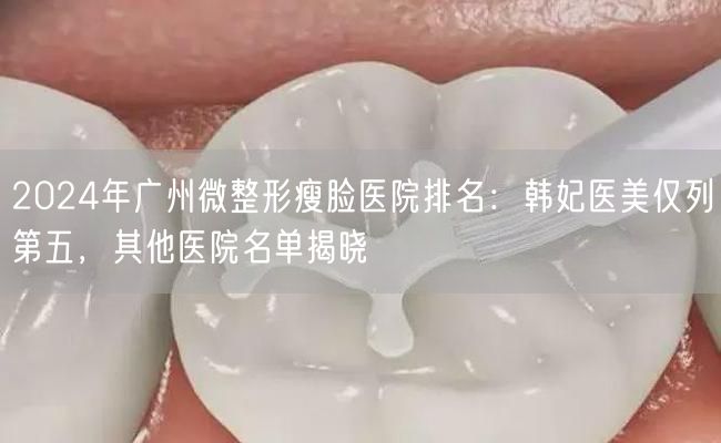 2024年广州微整形瘦脸医院排名：韩妃医美仅列第五，其他医院名单揭晓