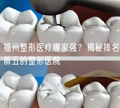 福州整形医疗哪家强？揭秘排名前五的整形医院