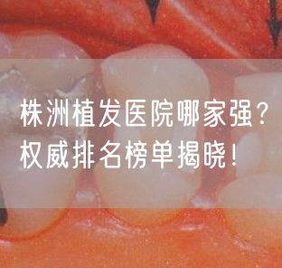 株洲植发医院哪家强？权威排名榜单揭晓！
