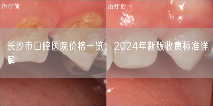 长沙市口腔医院价格一览：2024年新版收费标准详解