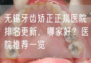 无锡牙齿矫正正规医院排名更新，哪家好？医院推荐一览