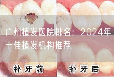 广州植发医院排名：2024年十佳植发机构推荐