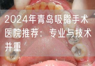 2024年青岛吸脂手术医院推荐：专业与技术并重
