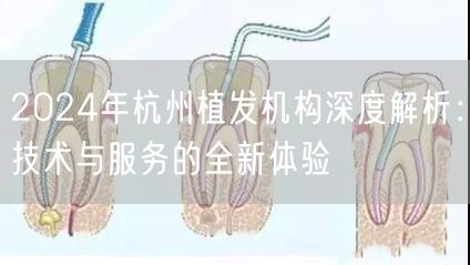 2024年杭州植发机构深度解析：技术与服务的全新体验