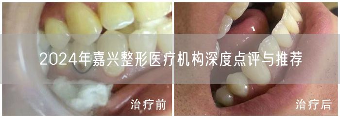 2024年嘉兴整形医疗机构深度点评与推荐
