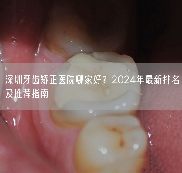 深圳牙齿矫正医院哪家好？2024年最新排名及推荐指南