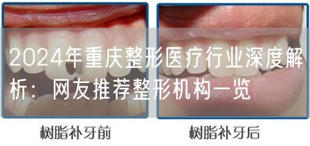 2024年重庆整形医疗行业深度解析：网友推荐整形机构一览