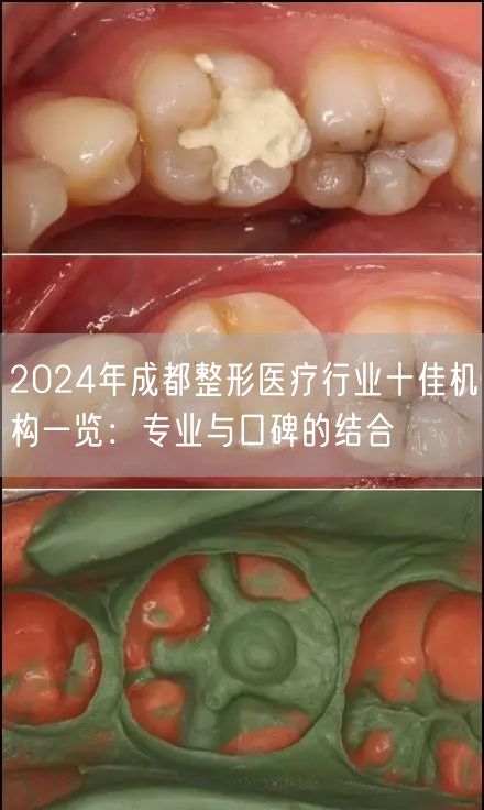 2024年成都整形医疗行业十佳机构一览：专业与口碑的结合