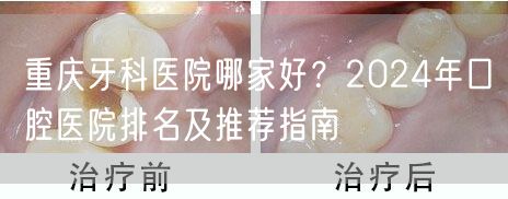 重庆牙科医院哪家好？2024年口腔医院排名及推荐指南