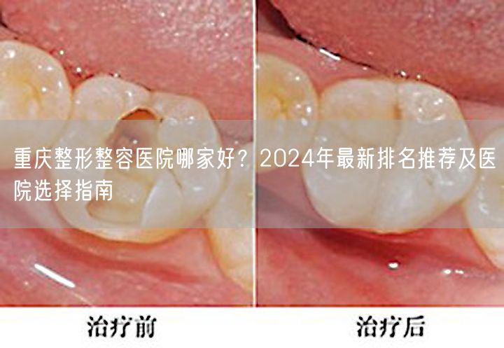 重庆整形整容医院哪家好？2024年最新排名推荐及医院选择指南