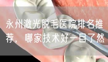 永州激光脱毛医院排名推荐，哪家技术好一目了然