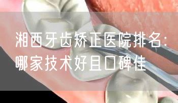 湘西牙齿矫正医院排名：哪家技术好且口碑佳