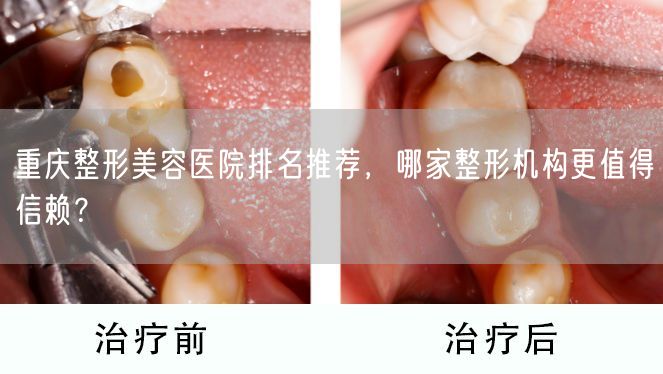 重庆整形美容医院排名推荐，哪家整形机构更值得信赖？