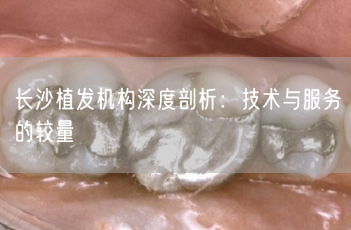 长沙植发机构深度剖析：技术与服务的较量