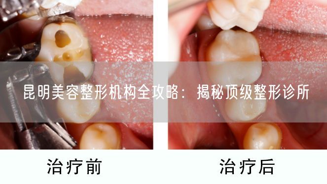 昆明美容整形机构全攻略：揭秘顶级整形诊所