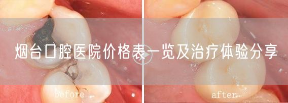 烟台口腔医院价格表一览及治疗体验分享