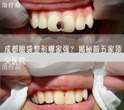 成都眼袋整形哪家强？揭秘前五家顶尖医院