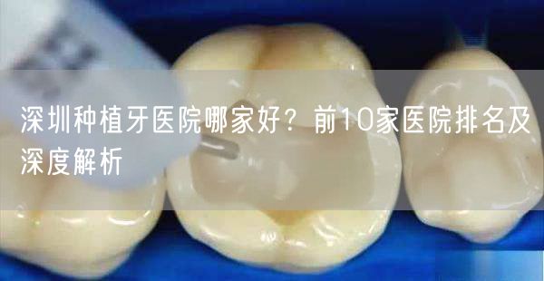 深圳种植牙医院哪家好？前10家医院排名及深度解析