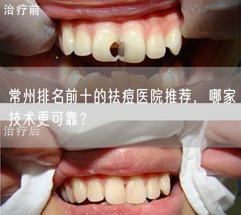 常州排名前十的祛痘医院推荐，哪家技术更可靠？