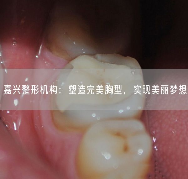 嘉兴整形机构：塑造完美胸型，实现美丽梦想