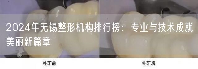 2024年无锡整形机构排行榜：专业与技术成就美丽新篇章