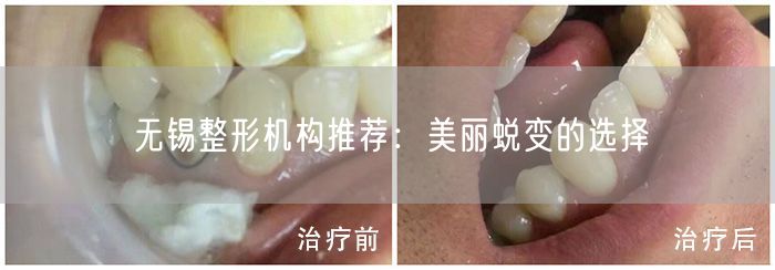 无锡整形机构推荐：美丽蜕变的选择