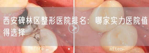 西安碑林区整形医院排名：哪家实力医院值得选择