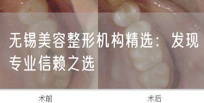 无锡美容整形机构精选：发现专业信赖之选